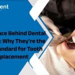 The Science Behind Dental Implants