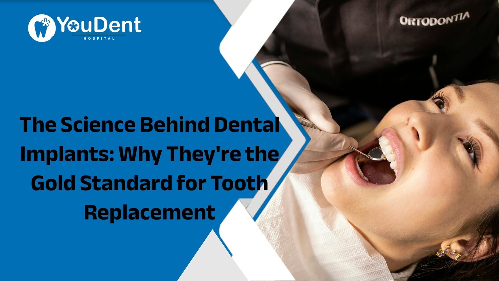 The Science Behind Dental Implants