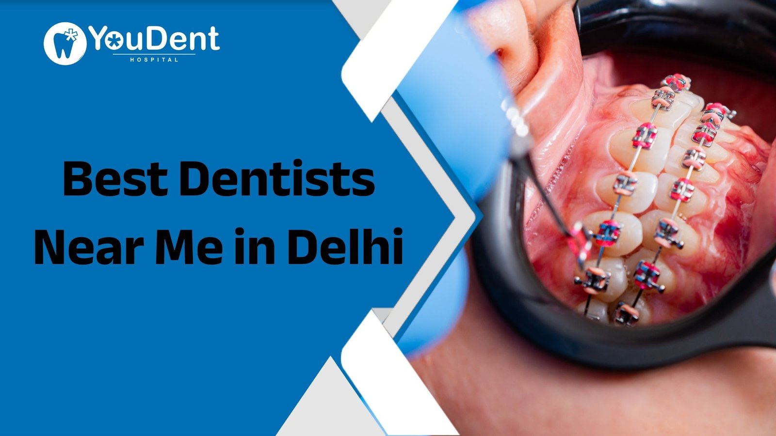 Best Dentists Near Me in Delhi